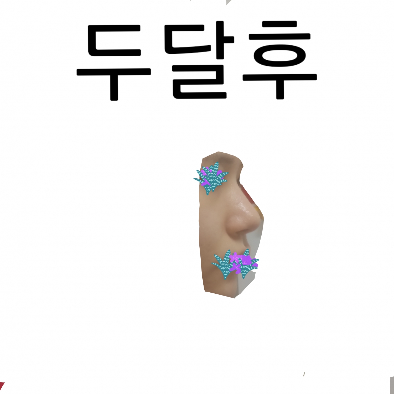 후