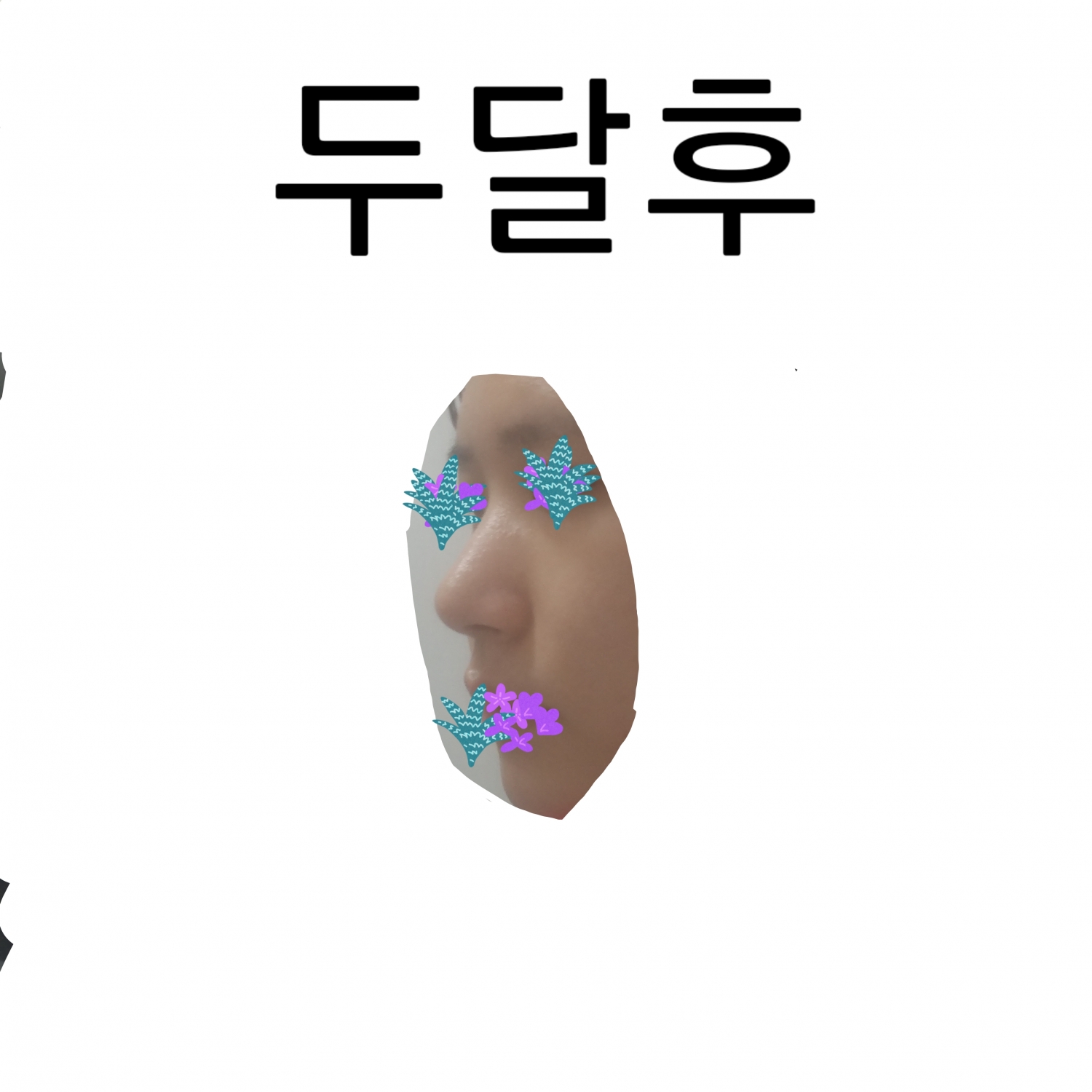 후