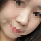 6mm 대애충 1년쯤 후기