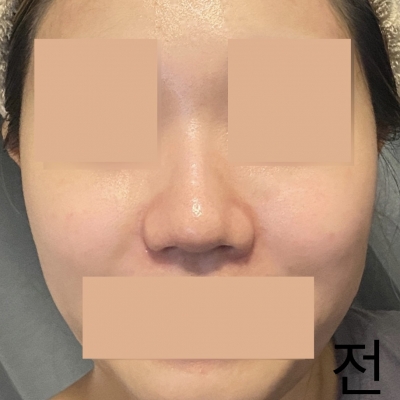 ㄹㅋㅋ성형외과