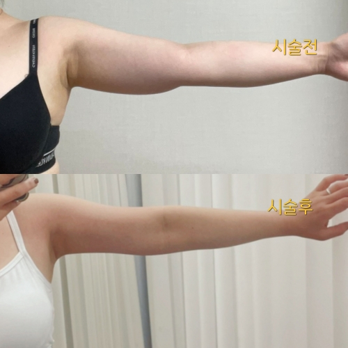 람스 두번한 사람있니..쨋든 2달만에 -7Cm 허리라인생김