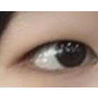 ㄹㅈㄷ 쌍수후기