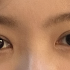 쌍수 후기