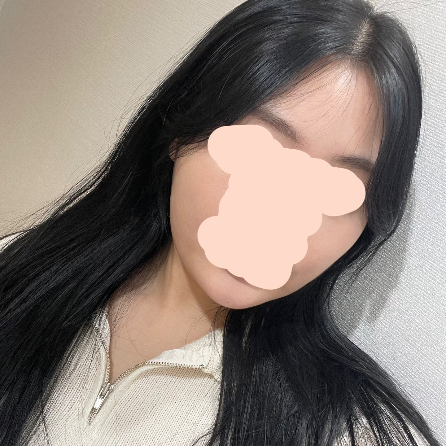 수술 전엔 셀카로 최대한 갸름하게 찍으려 해도 이정도 ?