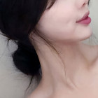 얼굴지방흡입+민트실리프팅 후기