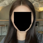 광대 3개월차 후기 ㅎㅎ