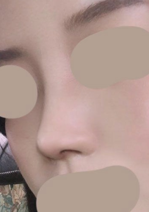 드디어 첫 코수술 하려한다. 드디어 첫 코수술 하려한다.